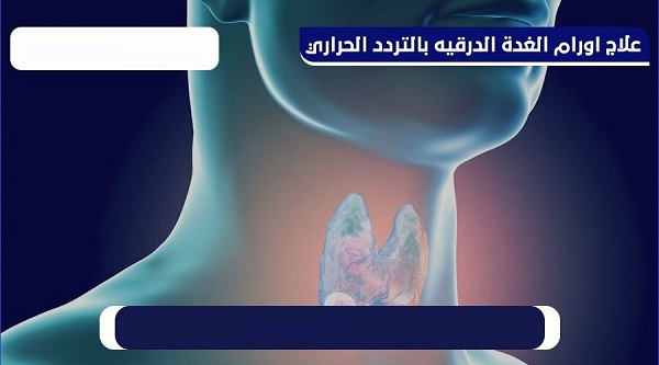 تجربتي مع التردد الحراري للغدة الدرقية